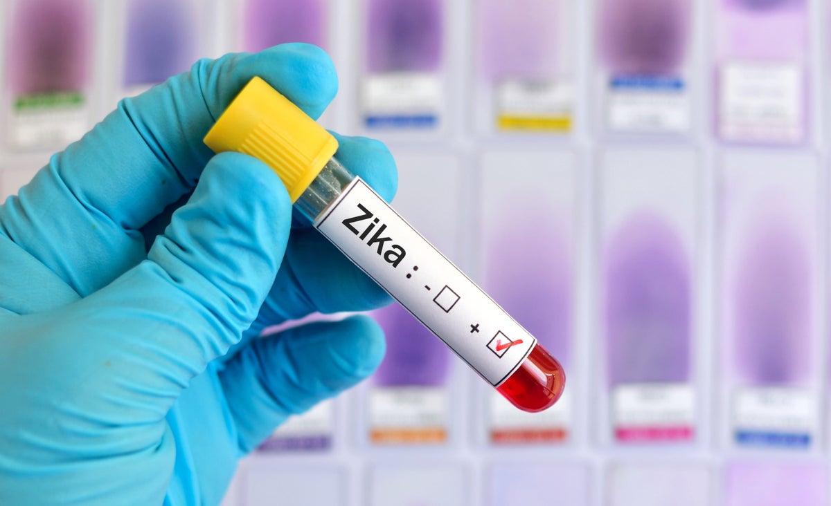 Zika Virus: What It Is, Affected Countries, Symptoms, Treatment and More [Guide]